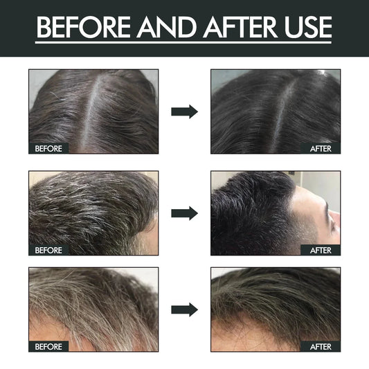 EELHOE Black Hair Spray Dye White to Black Serum Anti Gray Cover White Hair Remover Spray Scalp Nourishing Darkening Hair Spray - Cindorium